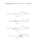 APPARATUS AND METHODS FOR ACCESSING AND REMOVING MATERIAL FROM BODY LUMENS diagram and image