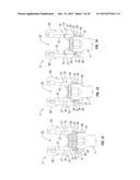 ORTHOPEDIC FIXATION DEVICES AND METHODS OF INSTALLATION THEREOF diagram and image