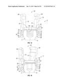 ORTHOPEDIC FIXATION DEVICES AND METHODS OF INSTALLATION THEREOF diagram and image