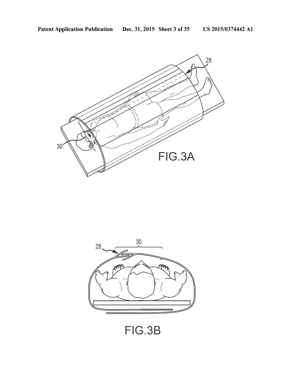 SURGICAL DRAPE WITH SEPARABLE ELEMENTS - diagram, schematic, and image 04