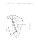 SURGICAL DRAPE WITH SEPARABLE ELEMENTS diagram and image