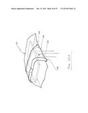 SURGICAL DRAPE WITH SEPARABLE ELEMENTS diagram and image