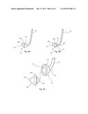 VASCULAR FILTER AND ANCHORING ARRANGEMENT THEREOF diagram and image