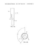 BRANCHED VESSEL ENDOLUMINAL DEVICE diagram and image