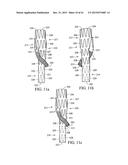 BRANCHED VESSEL ENDOLUMINAL DEVICE diagram and image