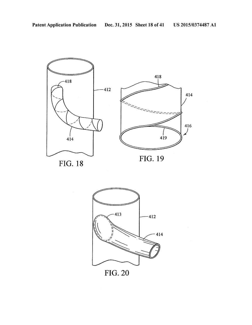 BRANCHED VESSEL ENDOLUMINAL DEVICE - diagram, schematic, and image 19