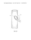 BRANCHED VESSEL ENDOLUMINAL DEVICE diagram and image