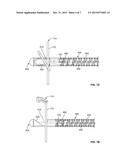 HEART VALVE REPAIR DEVICES FOR PLACEMENT IN VENTRICLE AND DELIVERY SYSTEMS     FOR IMPLANTING HEART VALVE REPAIR DEVICES diagram and image