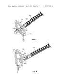 HEART VALVE REPAIR DEVICES FOR PLACEMENT IN VENTRICLE AND DELIVERY SYSTEMS     FOR IMPLANTING HEART VALVE REPAIR DEVICES diagram and image