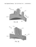 AUGMENTED GLENOID COMPONENTS AND DEVICES FOR IMPLANTING THE SAME diagram and image