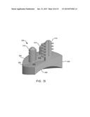 AUGMENTED GLENOID COMPONENTS AND DEVICES FOR IMPLANTING THE SAME diagram and image