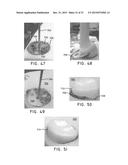 AUGMENTED GLENOID COMPONENTS AND DEVICES FOR IMPLANTING THE SAME diagram and image