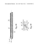 EXPANDABLE SPINAL INTERBODY AND INTRAVERTEBRAL BODY DEVICES diagram and image