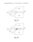 EXPANDABLE SPINAL INTERBODY AND INTRAVERTEBRAL BODY DEVICES diagram and image