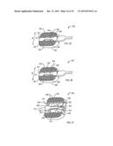 EXPANDABLE FUSION DEVICE AND METHOD OF INSTALLATION THEREOF diagram and image