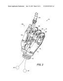 Prosthetics diagram and image