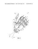 Prosthetics diagram and image