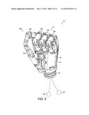 Prosthetics diagram and image