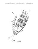 Prosthetics diagram and image