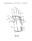 WRIST BRACE diagram and image