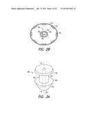 LACRIMAL IMPLANT DETECTION diagram and image