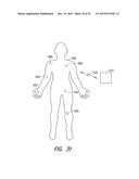 LACRIMAL IMPLANT DETECTION diagram and image