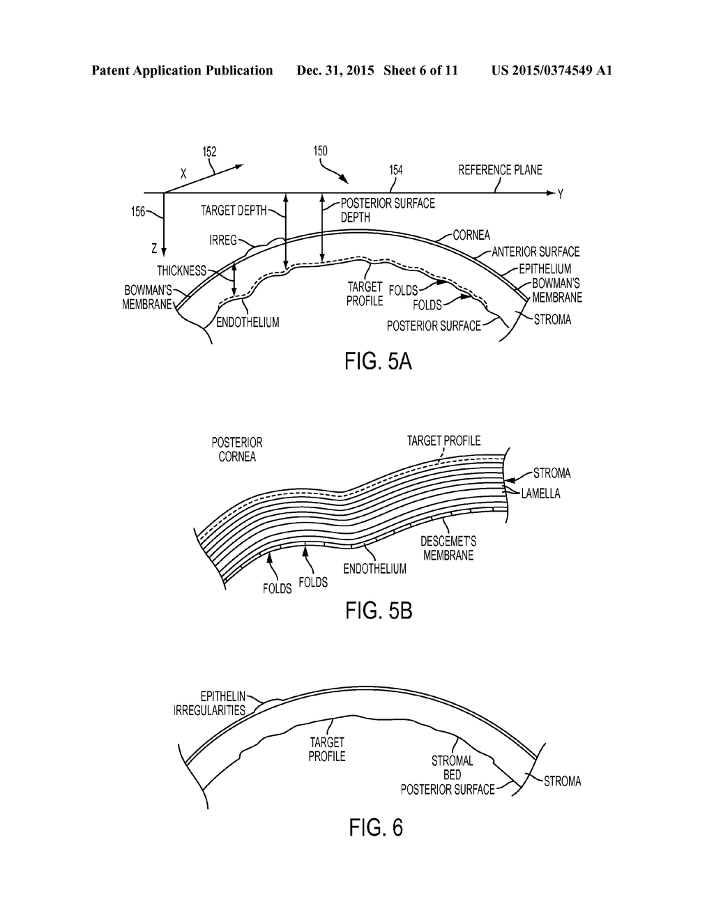 SYSTEM AND METHOD FOR LASER CORNEAL INCISIONS FOR KERATOPLASTY PROCEDURES - diagram, schematic, and image 07