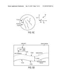 SYSTEM AND METHOD FOR LASER CORNEAL INCISIONS FOR KERATOPLASTY PROCEDURES diagram and image