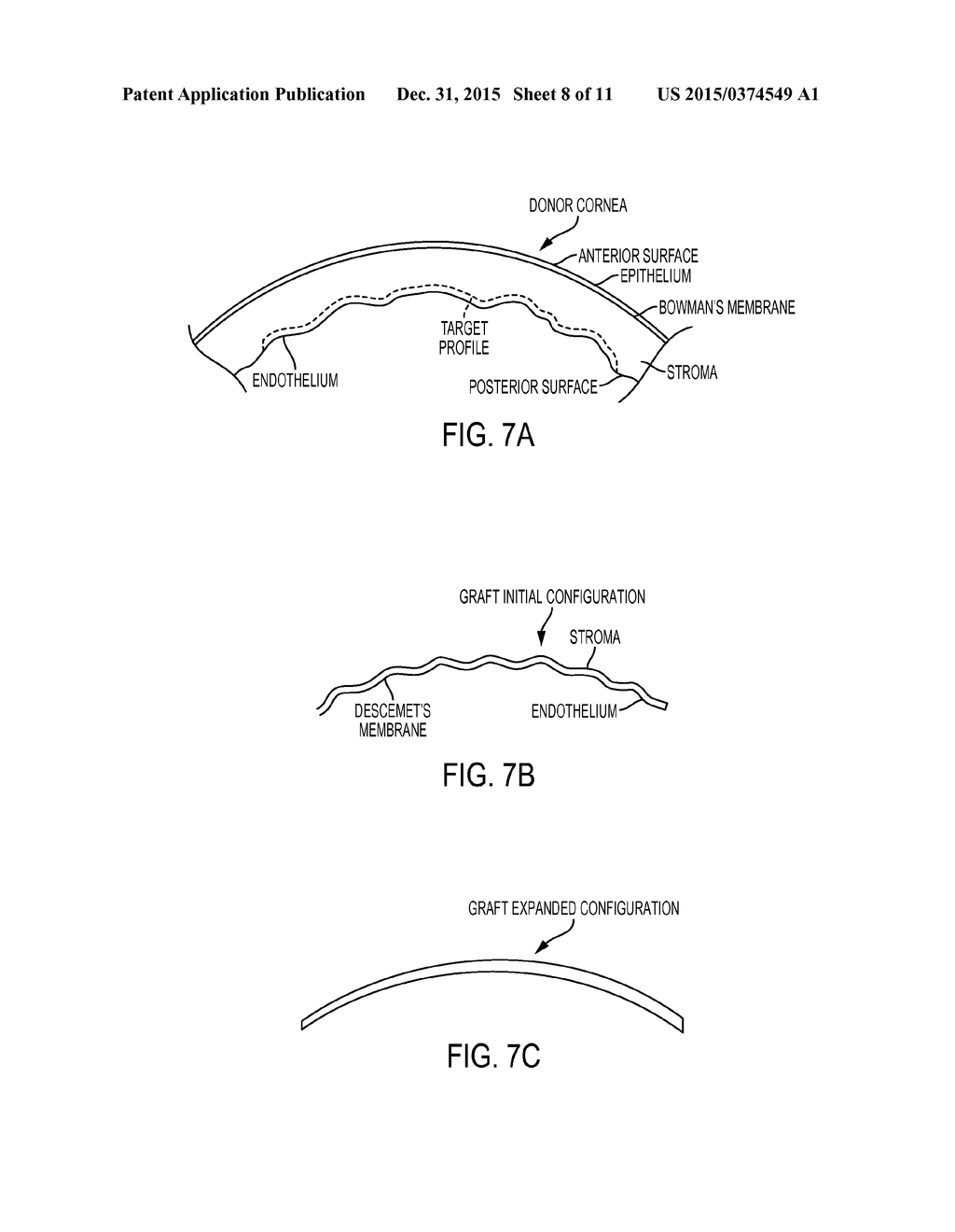 SYSTEM AND METHOD FOR LASER CORNEAL INCISIONS FOR KERATOPLASTY PROCEDURES - diagram, schematic, and image 09