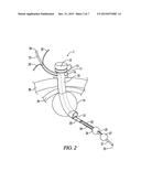 BARIATRIC DEVICE AND METHOD diagram and image