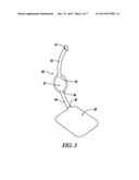 BARIATRIC DEVICE AND METHOD diagram and image