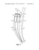 BARIATRIC DEVICE AND METHOD diagram and image