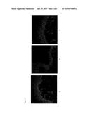 USE OF A COMPOSITION COMPRISING AVOCADO PERSEOSE IN THE PROTECTION OF     EPIDERMAL STEM CELLS diagram and image