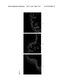 USE OF A COMPOSITION COMPRISING AVOCADO PERSEOSE IN THE PROTECTION OF     EPIDERMAL STEM CELLS diagram and image