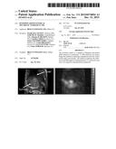 HYPERPOLARIZED ESTERS AS METABOLIC MARKERS IN MR diagram and image