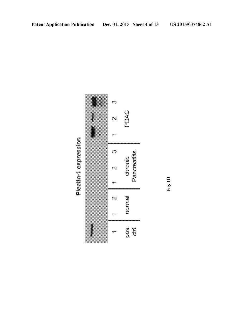 COMPOSITIONS AND METHODS FOR DETECTING PLECTIN-1 AS A BIOMARKER FOR CANCER - diagram, schematic, and image 05