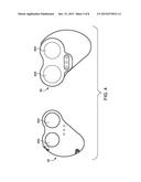 SHIELD ADAPTED TO FIT MEDICAL INJECTOR SYRINGE diagram and image