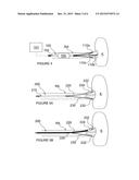 Methods and Apparatus for Multi-Vessel Renal Neuromodulation diagram and image