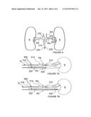 Methods and Apparatus for Multi-Vessel Renal Neuromodulation diagram and image