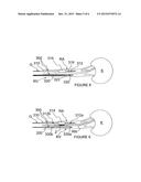 Methods and Apparatus for Multi-Vessel Renal Neuromodulation diagram and image