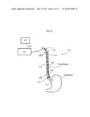 ESOPHAGEAL STIMULATION SYSTEM diagram and image