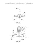 TECHNIQUES FOR PLACING MEDICAL LEADS FOR ELECTRICAL STIMULATION OF NERVE     TISSUE diagram and image