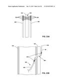 TECHNIQUES FOR PLACING MEDICAL LEADS FOR ELECTRICAL STIMULATION OF NERVE     TISSUE diagram and image