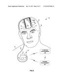 OPTICAL STIMULATION THERAPY diagram and image