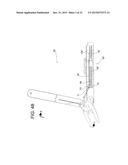 TENSION LOCKING TOOL diagram and image