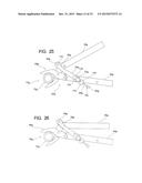 TENSION LOCKING TOOL diagram and image