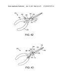 TENSION LOCKING TOOL diagram and image