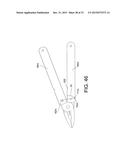 TENSION LOCKING TOOL diagram and image