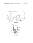 PLASTIC CONTAINERS HAVING BASE CONFIGURATIONS WITH UP-STAND WALLS HAVING A     PLURALITY OF RINGS, AND SYSTEMS, METHODS, AND BASE MOLDS THEREOF diagram and image