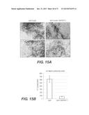 USE OF P3 OF BACTERIOPHAGE FUSION PROTEINS AS AMYLOID BINDING AGENTS diagram and image